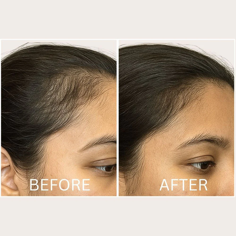 Brosse LED intensive stimulant la pousse des cheveux : réduit la chute