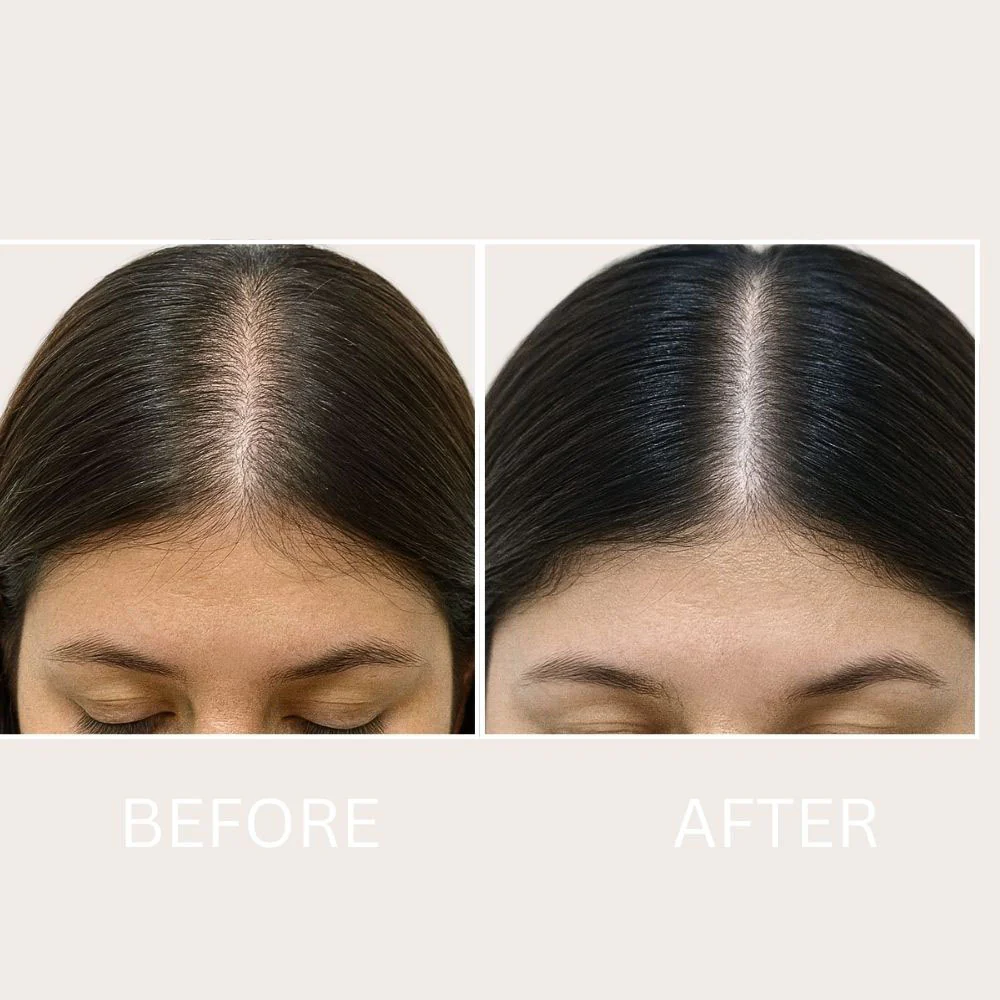 Brosse LED intensive stimulant la pousse des cheveux : réduit la chute