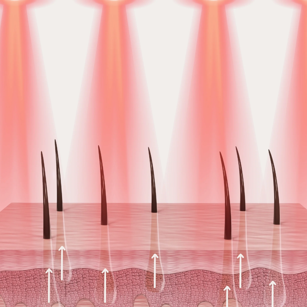 Brosse LED intensive stimulant la pousse des cheveux : réduit la chute